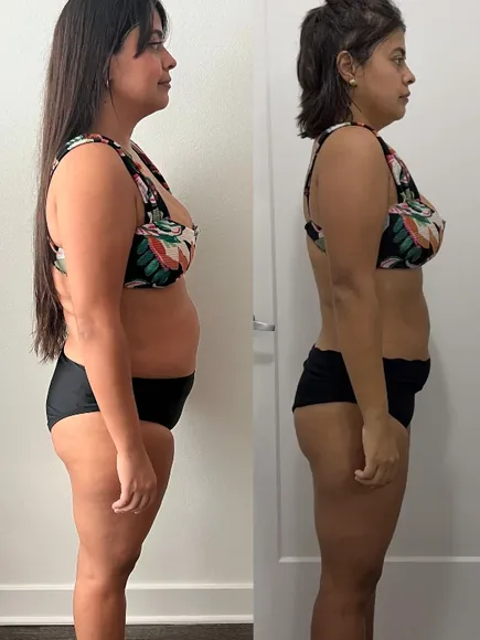 Transformación 10